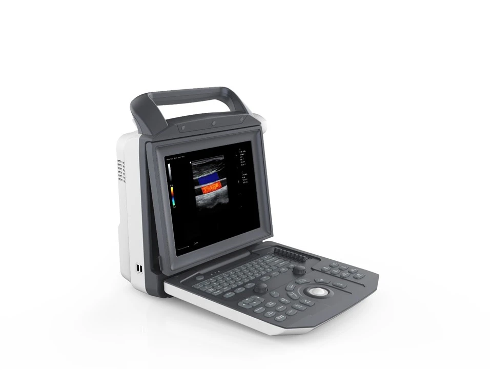 FTL-M5 Color Doppler Laptop Ultrasound System price