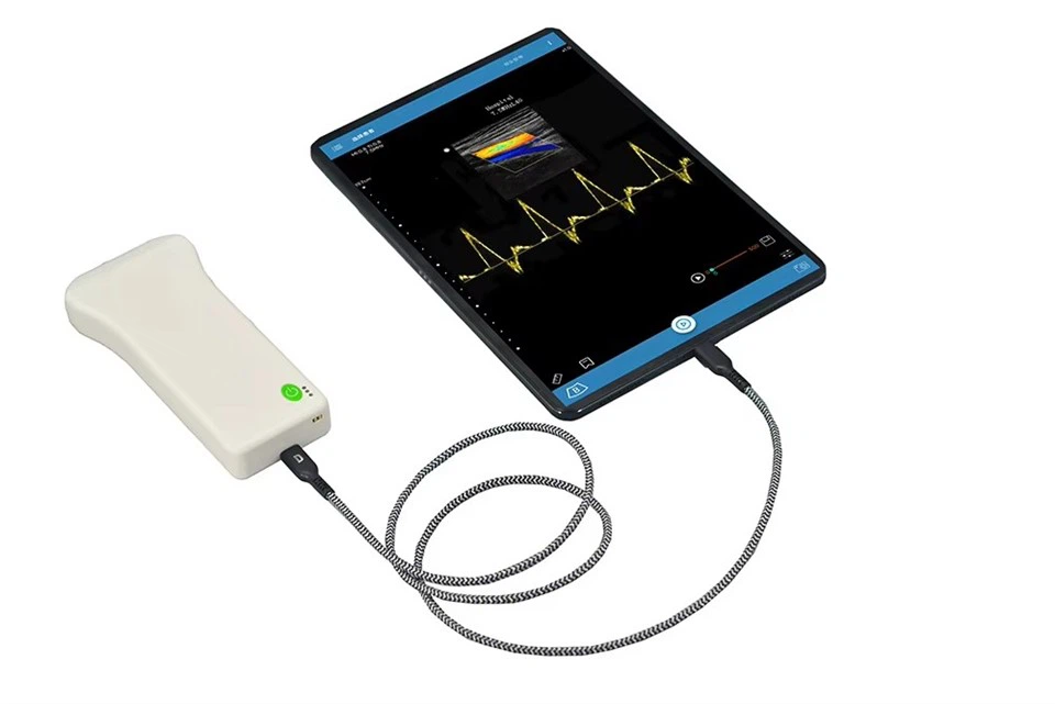 Handheld Wired Convex Probe Ultrasound Scanner factory