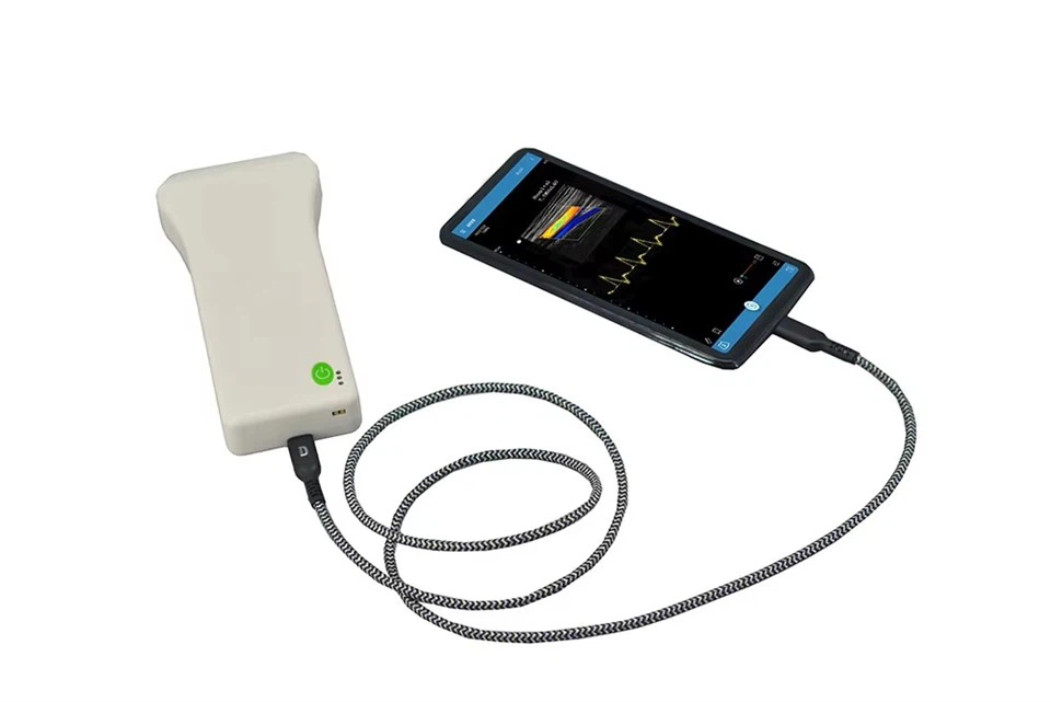 Handheld Wired Convex Probe Ultrasound Scanner suppliers