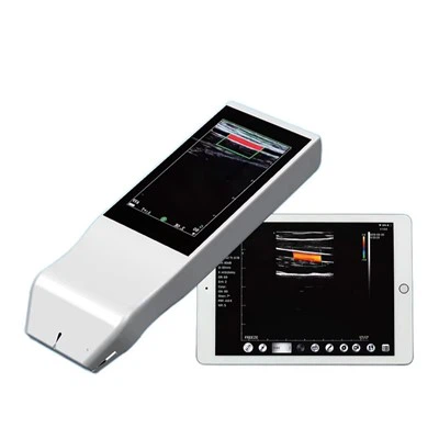 Máquina de ultrasonido inalámbrico portátil FTL-V5L